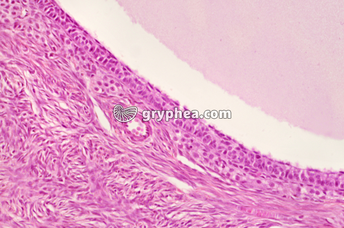 Paroi d'un follicule cavitaire (détail) x100 - gryphea.com